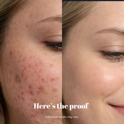 Copper Peptide Recovery Serum - GHK-Cu Formula