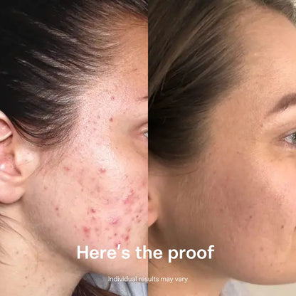 Copper Peptide Recovery Serum - GHK-Cu Formula