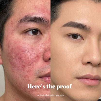 Copper Peptide Recovery Serum - GHK-Cu Formula