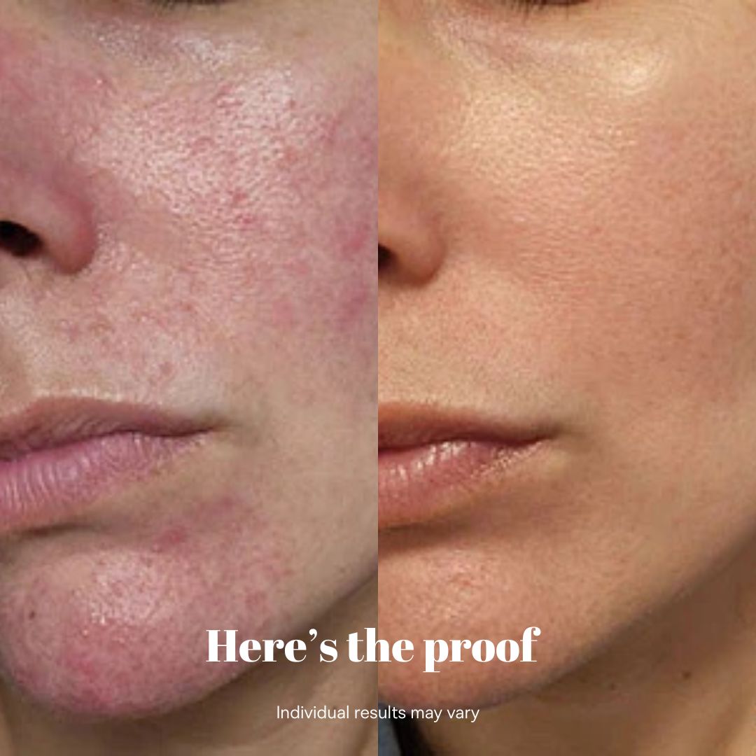 Copper Peptide Recovery Serum - GHK-Cu Formula